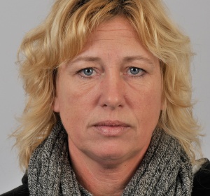 De rimpels in het voorhoofd verdwijnen De rimpels in het voorhoofd verdwijnen