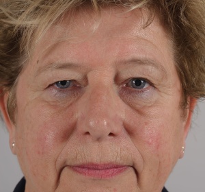 Een frisser uiterlijk Een frisser uiterlijk