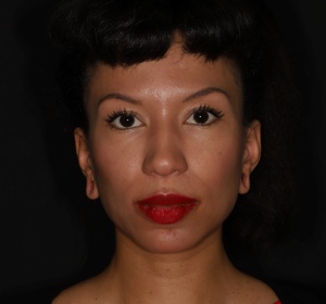 Reconstruction and closure of the earlobes