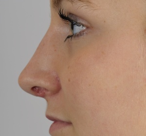 Definitie van de neuspunt (1).jpg