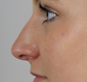 Definitie van de neuspunt (2).jpg