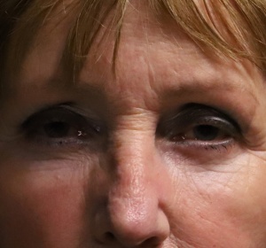 vet verwijderen en verplaatsen via de buitenzijde van de onderoogleden (1).jpg