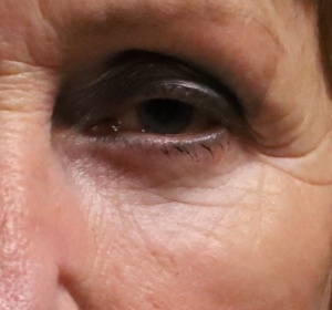 vet verwijderen en verplaatsen via de buitenzijde van de onderoogleden close-up(3).jpg