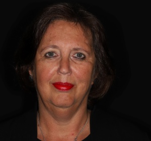 In some cases a forehead lift looks like a facelift