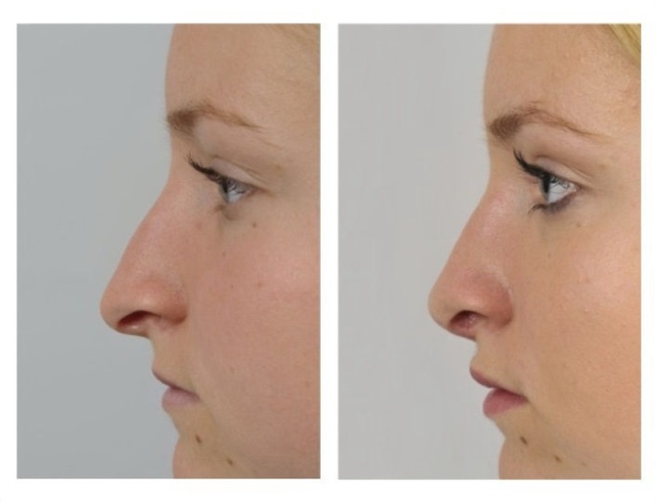 Small correction, whereby the nose tip rotates slightly upwards, for a friendlier look.