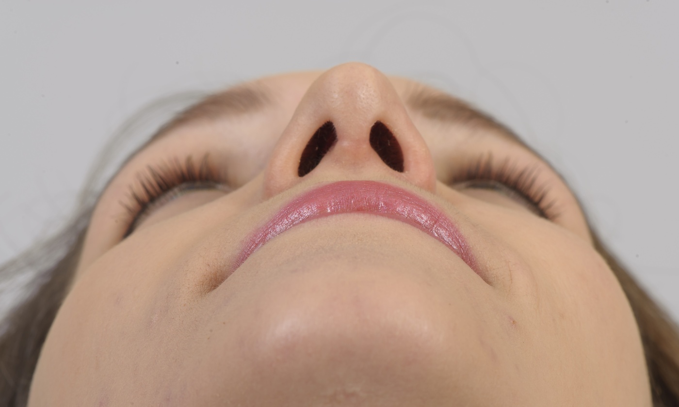 Correctie van de brede neuspunt (boxy tip)