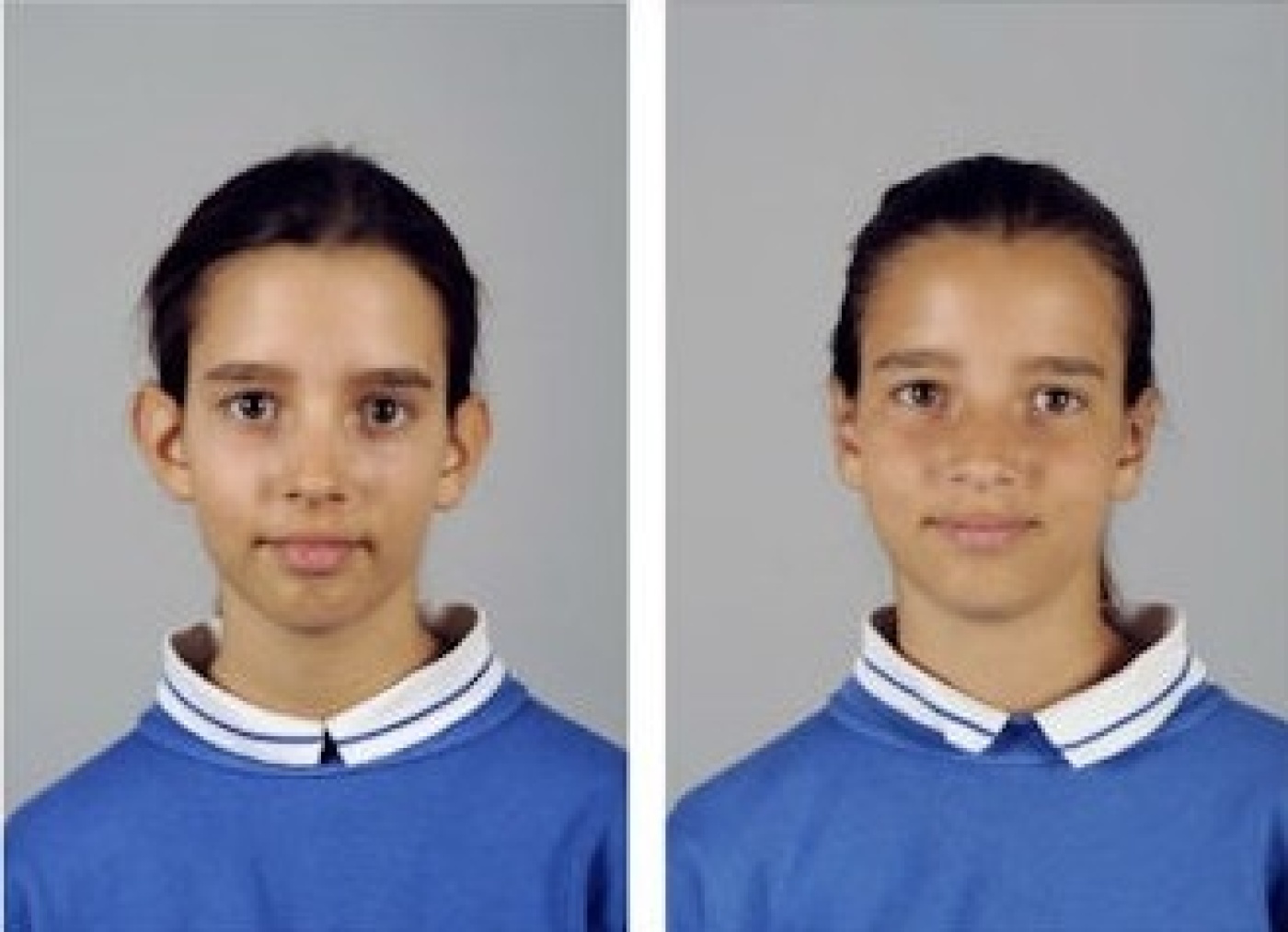 Voor en na de oorcorrectie (2) Voor en na de oorcorrectie (2)
