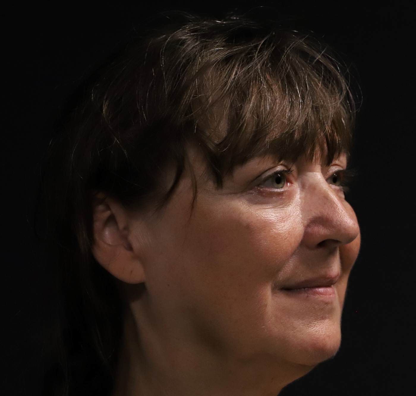 Een ooglidcorrectie verbetert de contour van het onderooglid