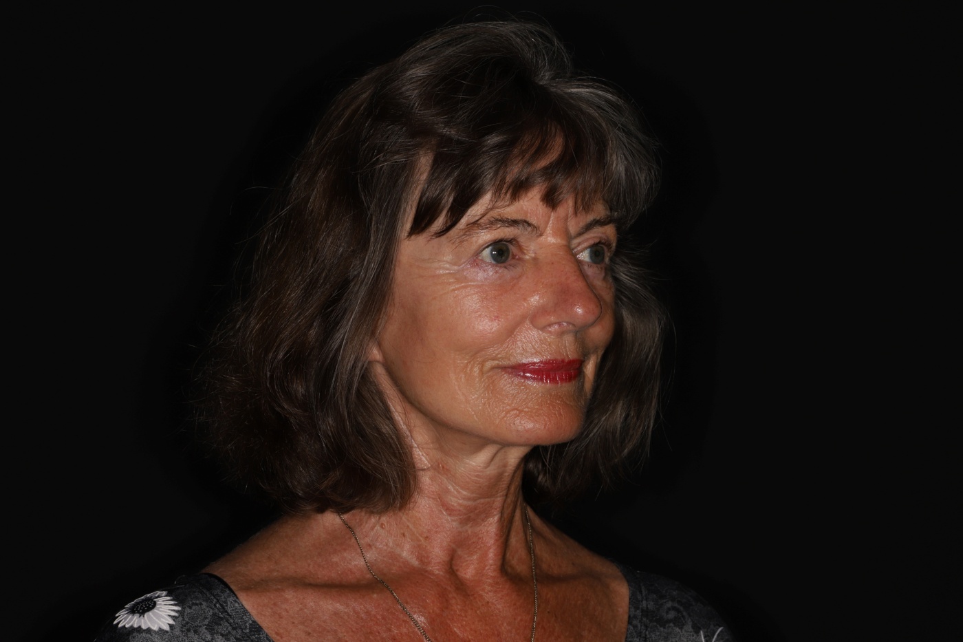 Herstel van de kaaklijn en een natuurlijke verbetering van de hals