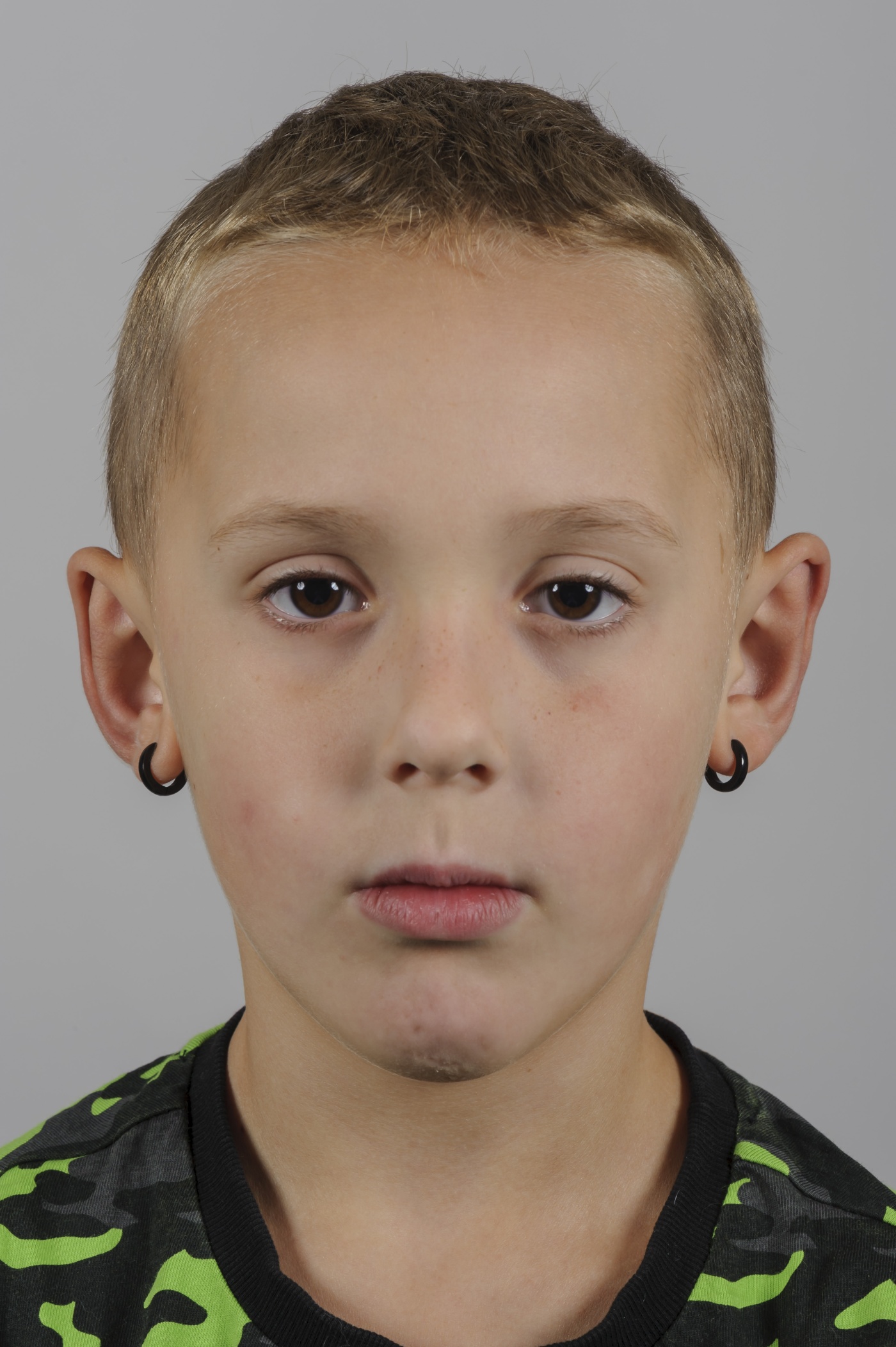 Although his self-confidence does not seem to suffer, correcting the ears improves his appearance