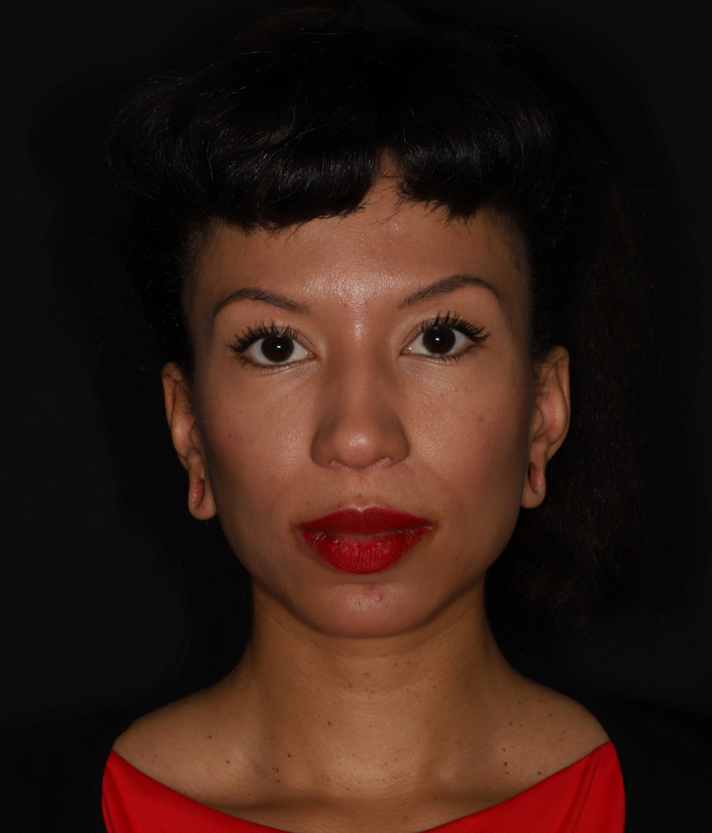 Reconstruction and closure of the earlobes