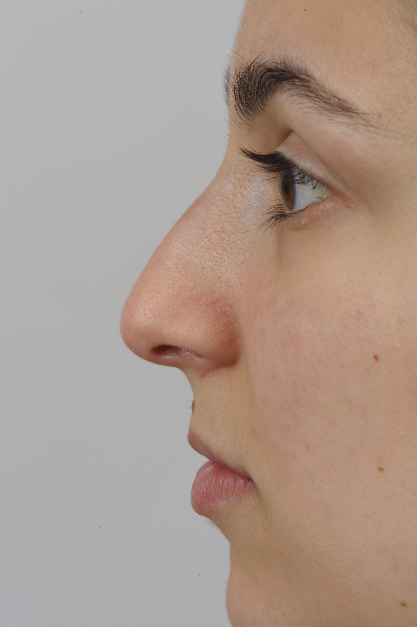 Lowering the bridge of the nose makes the tip more visible