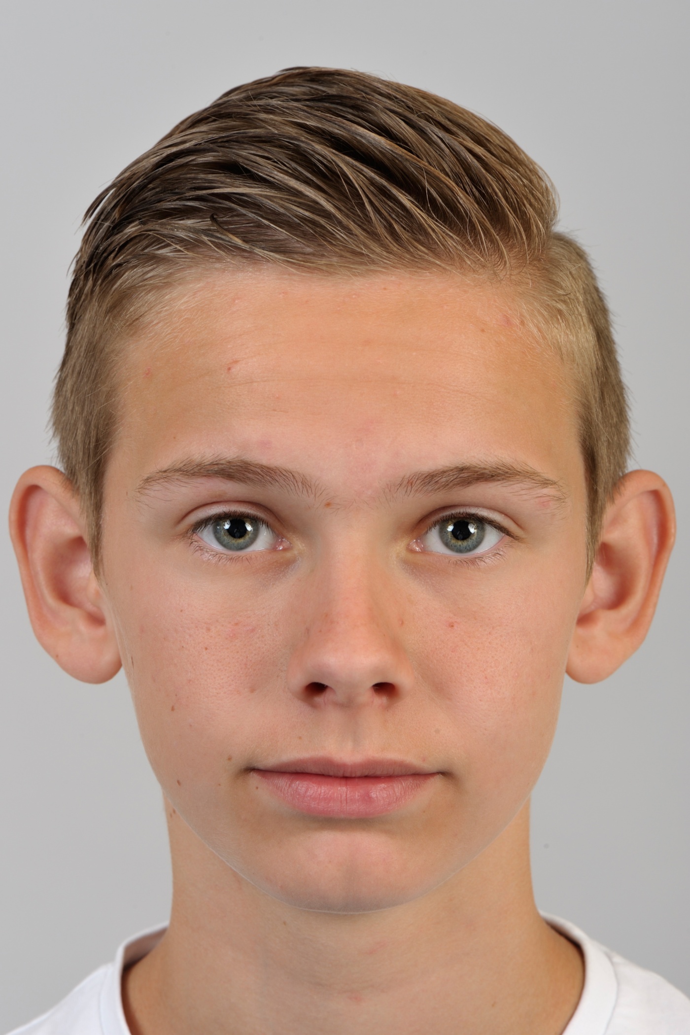 Correcting protruding ears improves appearance