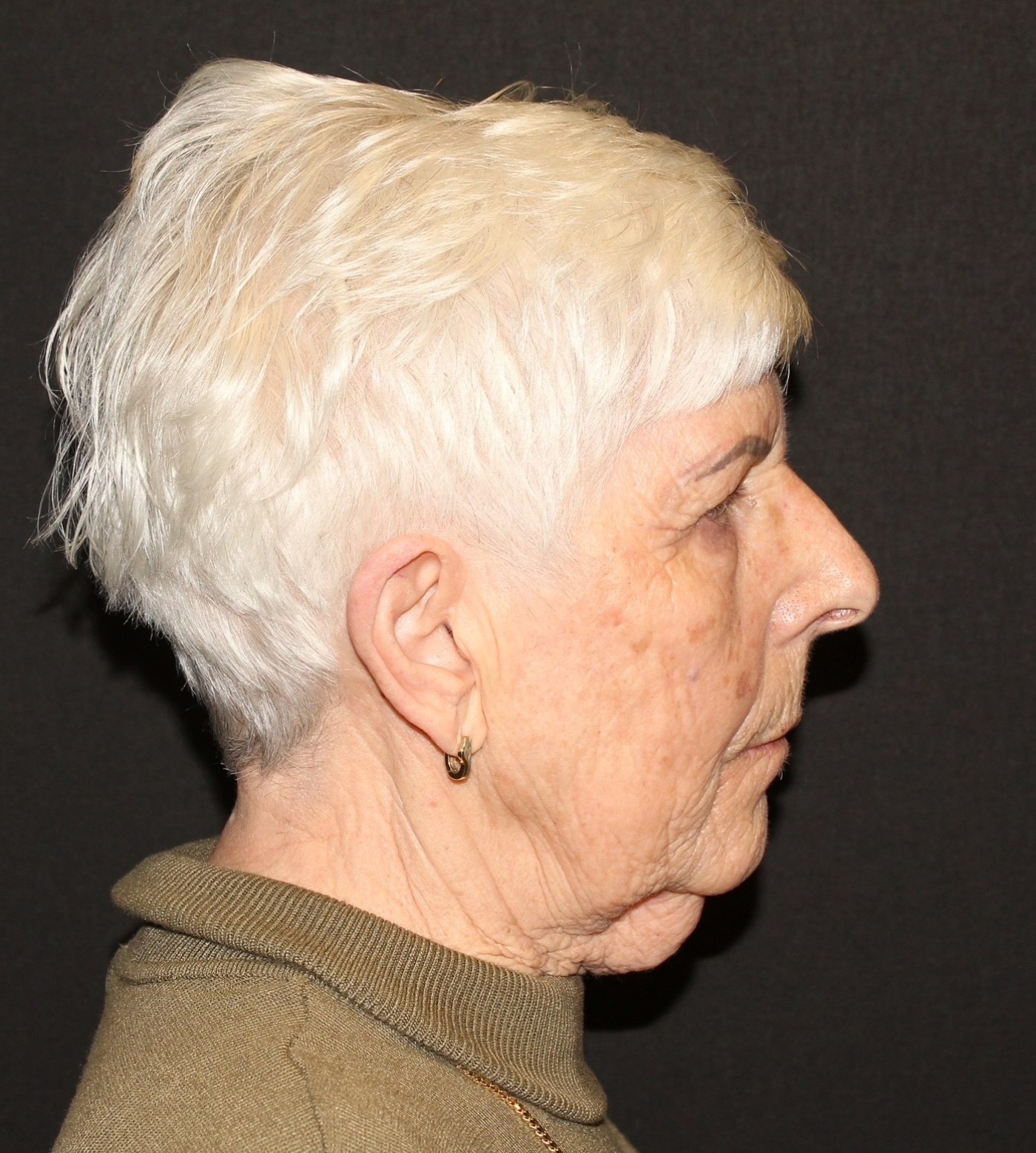 Kalkoenhals of "turtle neck"