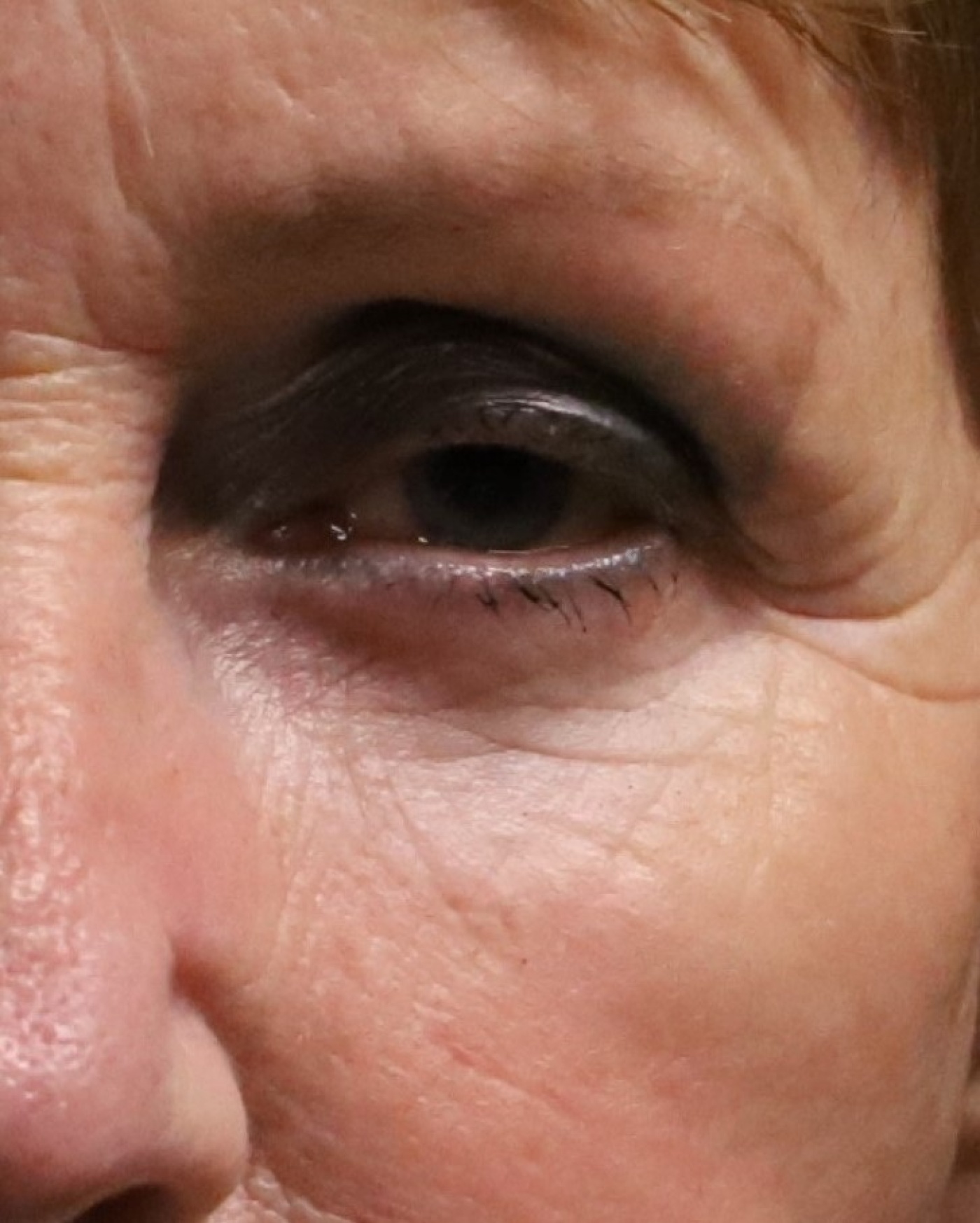 vet verwijderen en verplaatsen via de buitenzijde van de onderoogleden close-up(3).jpg