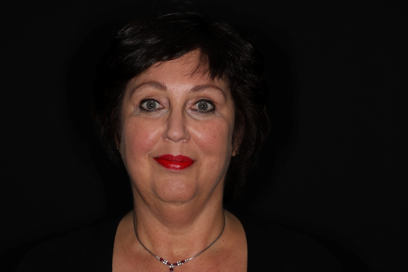 Een voorhoofdslift heeft soms een groter effect dan een facelift